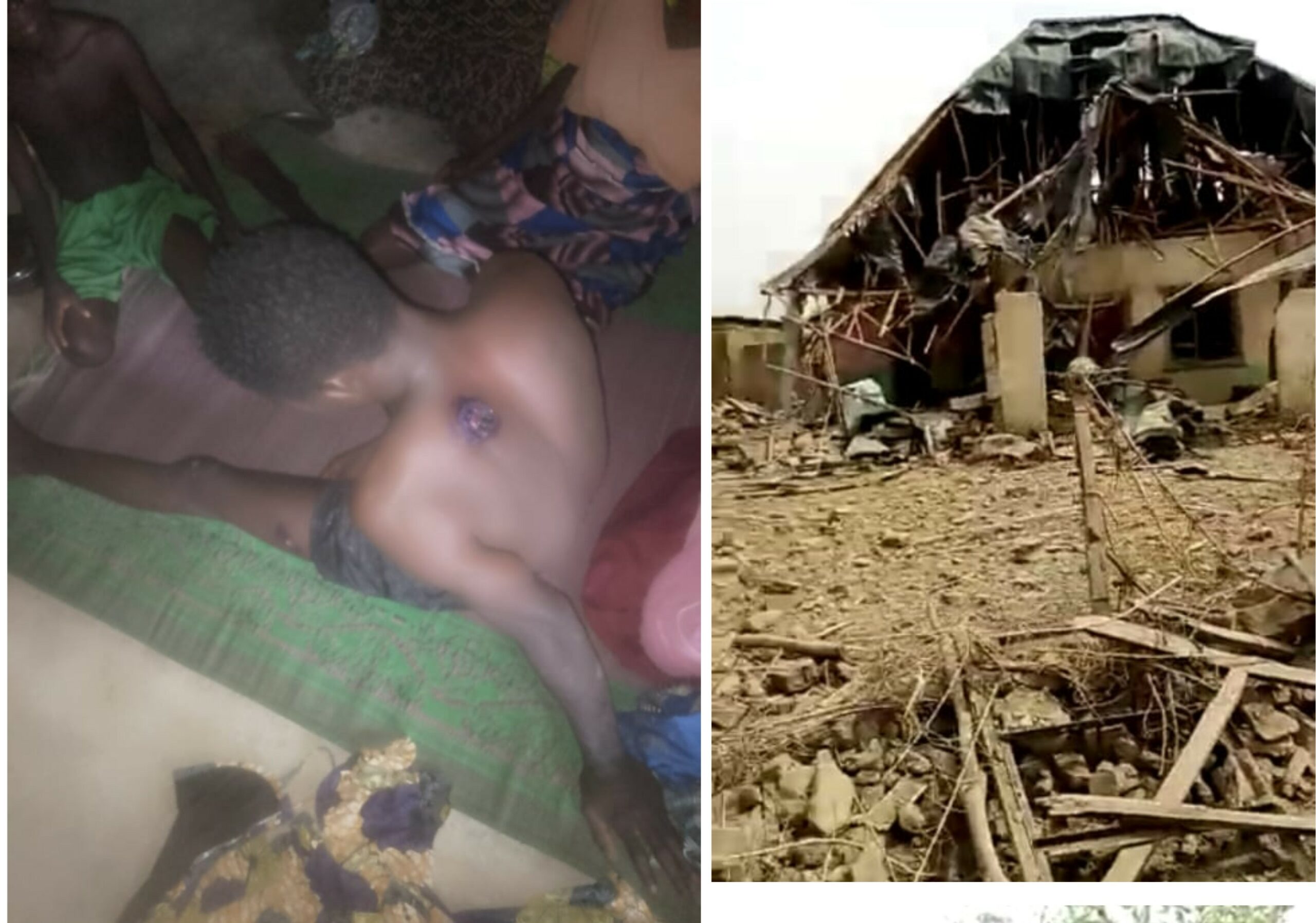 Pictures of persons injured and houses destroyed during the Air Force raid in Kurebe.
