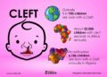 The statistics of children born with a cleft annually