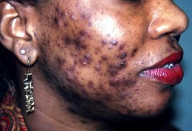 Has bad skin problems (1)