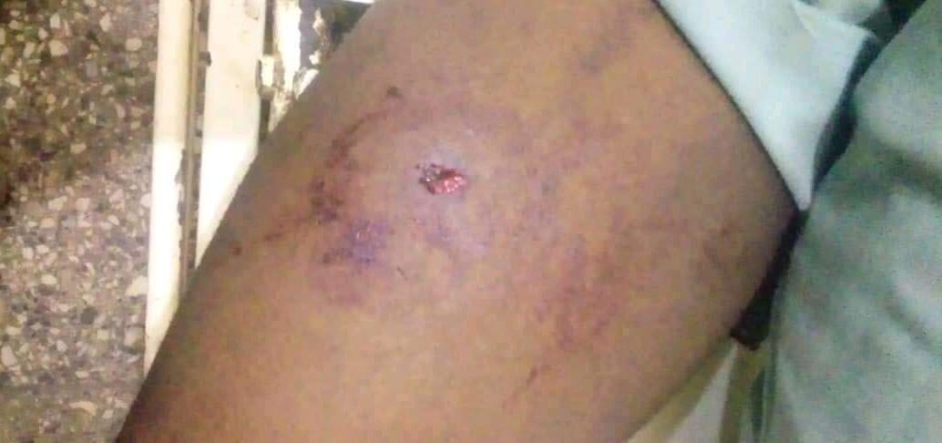 The injuries suffered by one of the victims