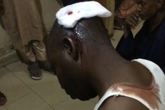 Policeman shoots man twice over disagreement in Zamfara - Vimarsana News