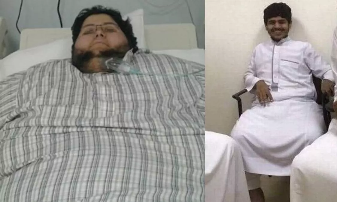 Khalid Bin Mohsen Shaari Former World s Heaviest Man Now Weighs 63kg Khalid Bin Mohsen Shaari Former World s Heaviest Man Now Weighs 63kg