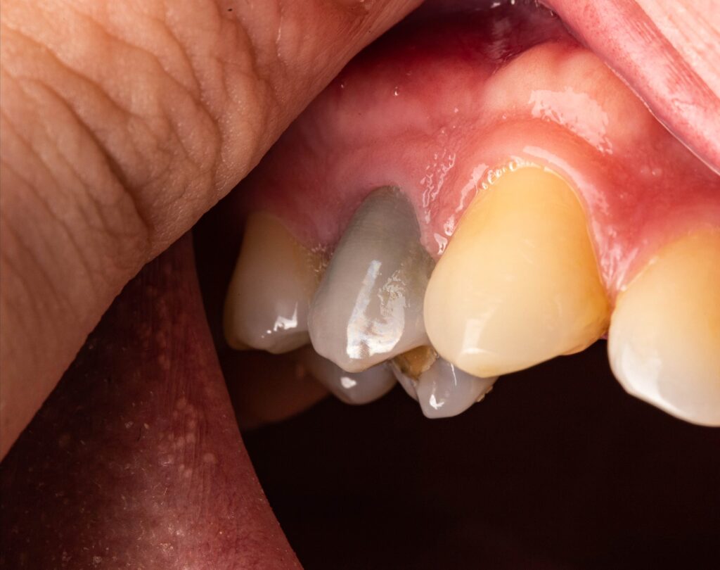 PT Health Watch: Why toothache remains common despite being preventable