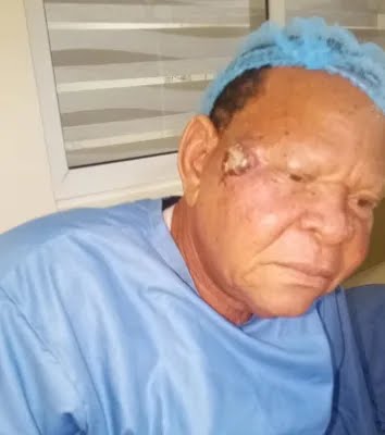 Baba Elesho undergoes surgery, dismisses cancer speculations